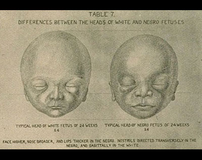 1921-white-negro-fetuses-cold-spring-harbor-laboratory